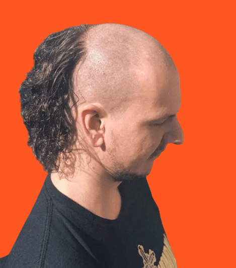 Curly Skullet